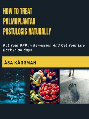 cover image of How to Treat Palmoplantar Pustulosis Naturally